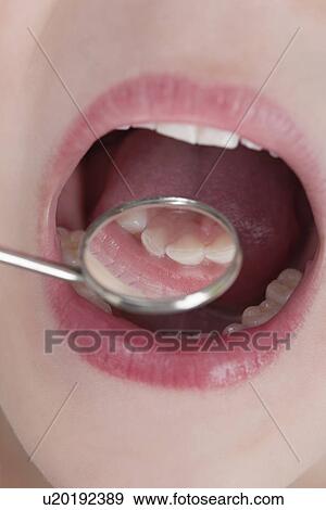 Stock Photo - USA, Illinois, Metamora, Close-up of dentist mirror in child's (6-7) mouth. Fotosearch