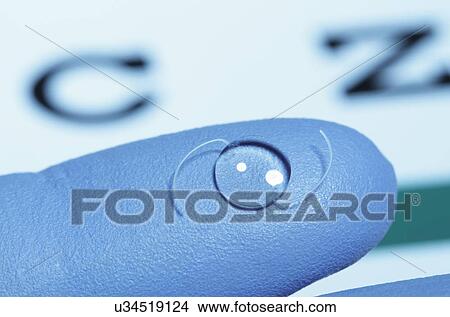 Picture - Intraocular lens on gloved finger. Intraocular lens is an artificial lens surgically implanted in the human eye following extraction of the natural crystalline lens clouded by cataract.. Fotosearch