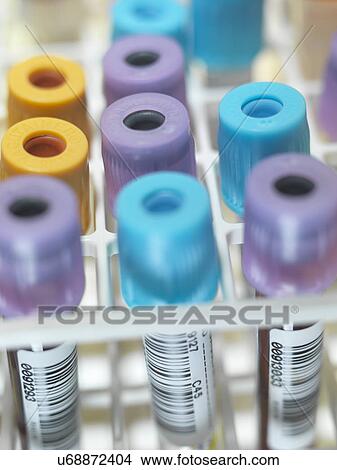 Picture - A row of human blood and chemistry samples awaiting testing in the lab. Fotosearch
