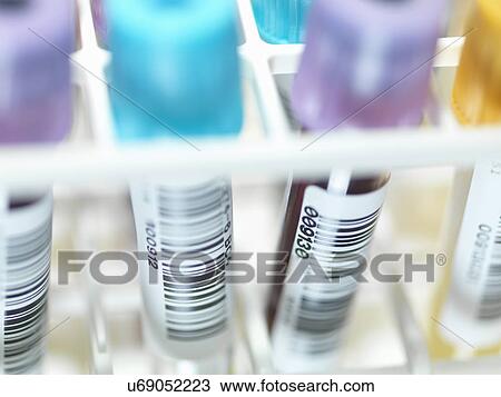 Stock Image - A row of human blood and chemistry samples awaiting testing in the lab. Fotosearch