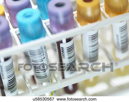 Stock Photo - A row of human blood and chemistry samples awaiting testing in the lab. Fotosearch