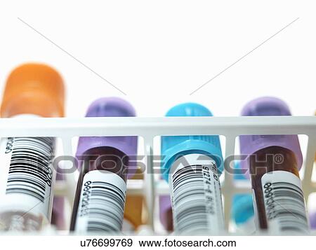 A row of human blood and chemistry samples awaiting testing in the lab View Large Photo Image Stock Photo - A row of human blood and chemistry samples awaiting testing in the lab. Fotosearch