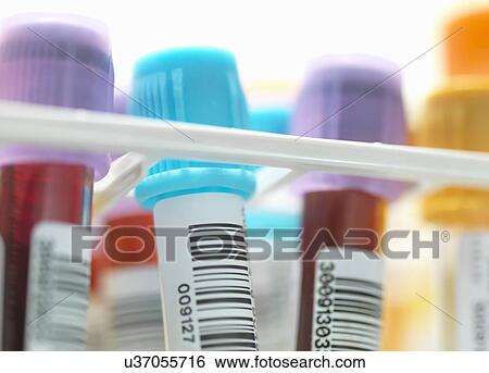 Stock Photograph - A row of human blood and chemistry samples awaiting testing in the lab. Fotosearch
