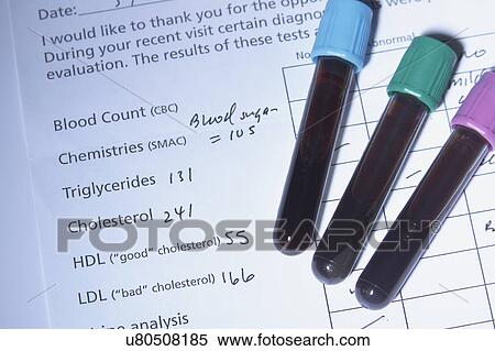 Stock Photography - Blood tubes on the results of blood testing, including testing for cholesterol. Such testing is done commonly as part of a yearly health checkup. Synthetic blood is used in this studio shot. Fotosearch