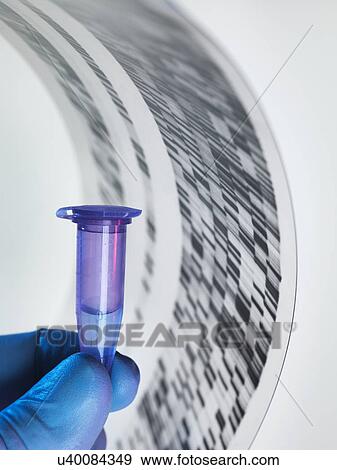 Stock Photo - Genetic sample and DNA autoradiogram. Fotosearch