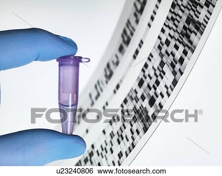 Stock Photograph - Genetic sample and DNA autoradiogram. Fotosearch