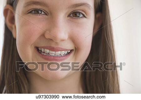 Stock Image - girl (10-11) wearing dental braces smiling. Fotosearch