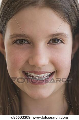 girl (10-11) wearing dental braces smiling View Large Photo Image Stock Photo - girl (10-11) wearing dental braces smiling. Fotosearch