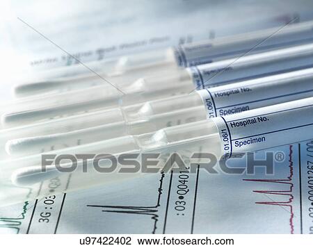 A row of DNA samples from family members being genetically tested for paternity View Large Photo Image Stock Image - A row of DNA samples from family members being genetically tested for paternity. Fotosearch