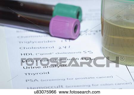 Stock Photograph - Blood tubes and urine sample on the results of tests done as part of a yearly health checkup, including tests for cholesterol. Fotosearch