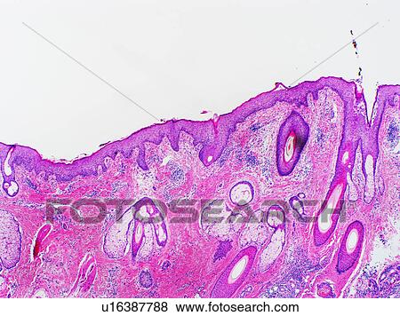 H&E stain, light microscopy, normal skin of scalp View Large Photo Image Stock Photo - H&E stain, light microscopy, normal skin of scalp. Fotosearch
