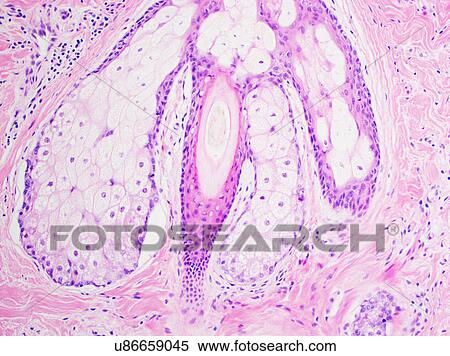 H&E stain, light microscopy, normal hair follicle View Large Photo Image Stock Photography - H&E stain, light microscopy, normal hair follicle. Fotosearch