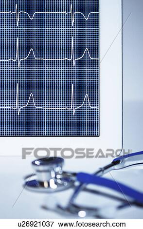 Acoustic stethoscope and electrocardiogram (pulse trace) displayed on a digital tablet screen View Large Photo Image Stock Photo - Acoustic stethoscope and electrocardiogram (pulse trace) displayed on a digital tablet screen. Fotosearch