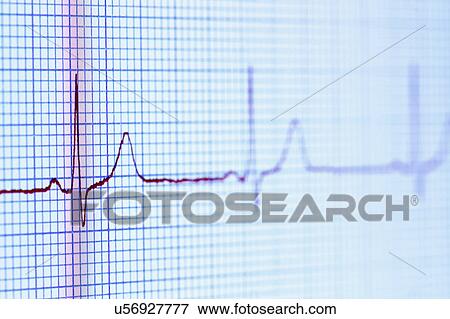Stock Photo - Electrocardiogram (pulse trace) displayed on a digital tablet screen. Fotosearch
