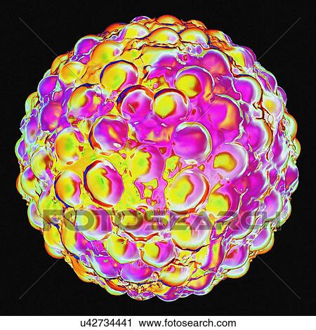 Hepatitis a, artwork View Large Illustration Clip Art - Hepatitis a, artwork. Fotosearch