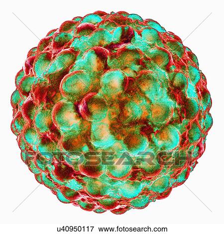 Stock Illustration - Hepatitis a, artwork. Fotosearch