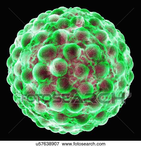 Stock Illustration - Hepatitis a, artwork. Fotosearch