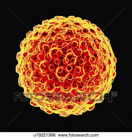 Stock Illustration - Herpes simplex, artwork. Fotosearch