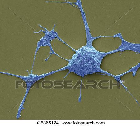 Stock Illustration - Neurone, SEM. Fotosearch