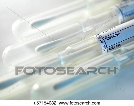 Buccal swabs used to obtain dna View Large Photo Image Stock Image - Buccal swabs used to obtain dna. Fotosearch