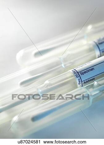 Buccal swabs used to obtain dna View Large Photo Image Stock Image - Buccal swabs used to obtain dna. Fotosearch