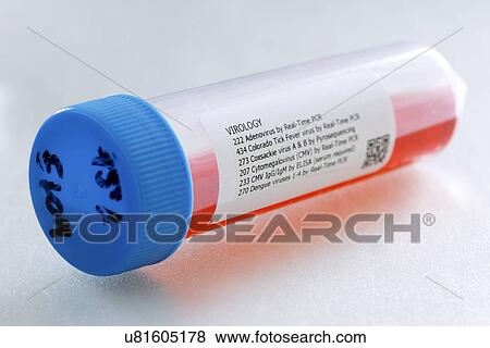 Stock Photo - Container used in virus detection. Fotosearch