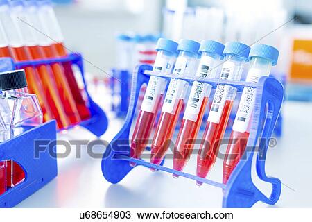 Stock Image - Eppendorf tubes used in Lab tests. Fotosearch
