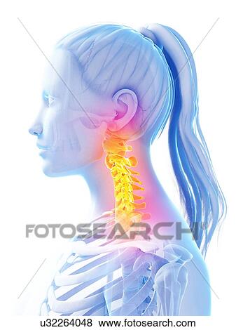 Stock Illustration - Human cervical spine, illustration. Fotosearch