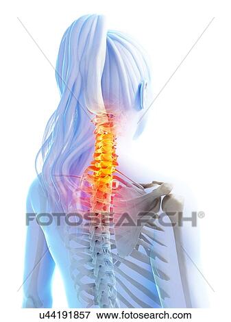 Stock Illustration - Human cervical spine, illustration. Fotosearch