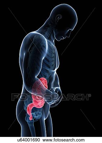 Clipart - Human intestine pain, illustration. Fotosearch
