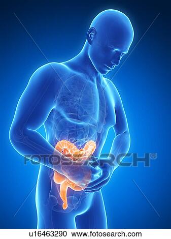 Clipart - Human large intestine pain, illustration. Fotosearch