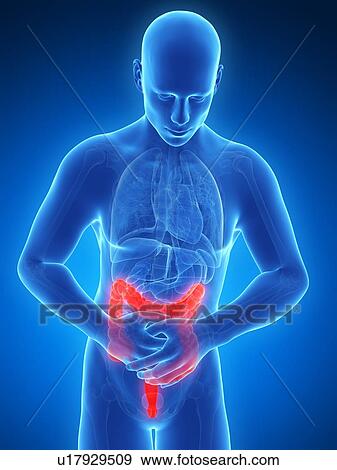 Human large intestine pain, illustration View Large Illustration Stock Illustration - Human large intestine pain, illustration. Fotosearch