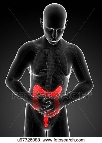 Human large intestine pain, illustration View Large Illustration Stock Illustration - Human large intestine pain, illustration. Fotosearch