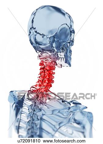 Human neck pain, illustration View Large Illustration Clipart - Human neck pain, illustration. Fotosearch