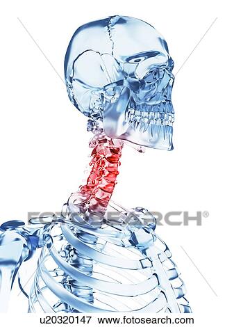 Human neck pain, illustration View Large Illustration Stock Illustration - Human neck pain, illustration. Fotosearch