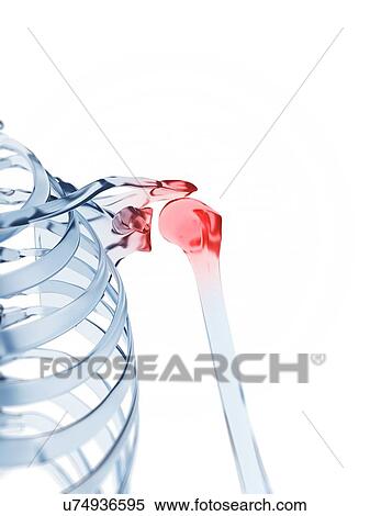 Stock Illustration - Human shoulder pain, illustration. Fotosearch