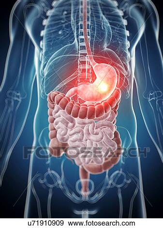Human stomach pain, illustration View Large Illustration Stock Illustration - Human stomach pain, illustration. Fotosearch