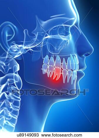 Drawing - Human tooth pain, illustration. Fotosearch