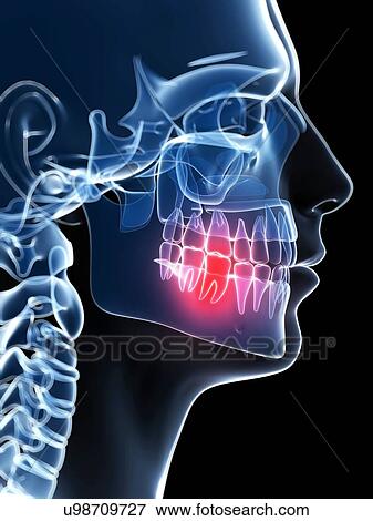 Human tooth pain, illustration View Large Illustration Stock Illustration - Human tooth pain, illustration. Fotosearch