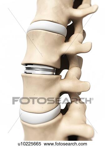 Stock Illustration - Human vertebrae, illustration. Fotosearch