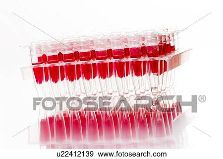 Medical samples in a test tube rack View Large Photo Image Stock Photo - Medical samples in a test tube rack. Fotosearch