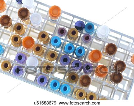 Stock Photo - Medical samples in a test tube rack. Fotosearch