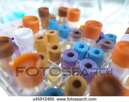 Stock Photography - Medical samples in test tubes. Fotosearch