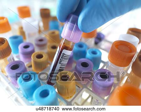 Stock Image - Person selecting a blood sample. Fotosearch