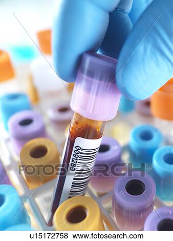 Stock Photo - Person selecting a blood sample. Fotosearch