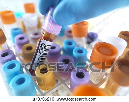 Stock Photograph - Person selecting a blood sample. Fotosearch