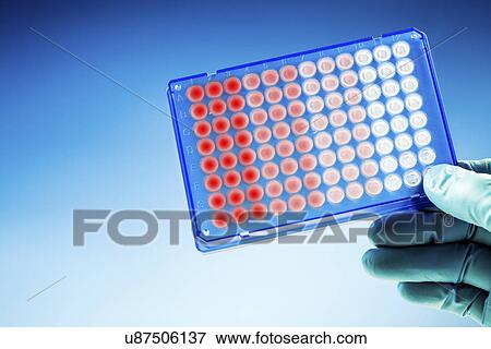 Stock Photo - Test tubes with medical samples. Fotosearch