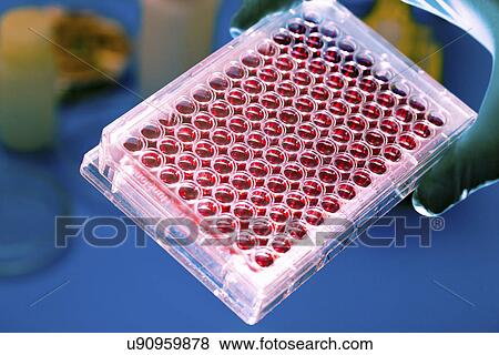 Stock Photo - Test tubes with medical samples. Fotosearch