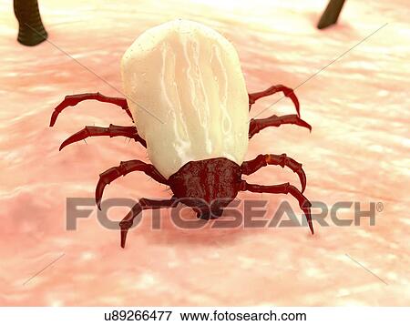 Tick feeding, illustration View Large Illustration Stock Illustration - Tick feeding, illustration. Fotosearch
