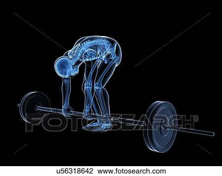 Weight lifting, incorrect posture View Large Illustration Drawing - Weight lifting, incorrect posture. Fotosearch